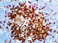 CD43 (MT1), MMab MAIN