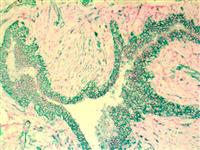 CD44 (BSB-12), MMab MAIN