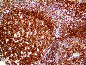 CD45 (2B11 & PD7/26), MMab MAIN