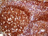 CD45 (2B11 & PD7/26), MMab MAIN