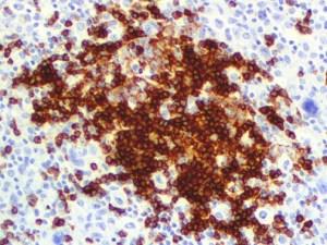 CD45RA (4KB5), MMab MAIN