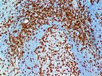 CD45RO (UCHL-1), MMab MAIN