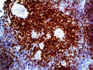 CD5 (RBT-CD5), RMab MAIN