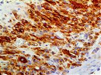 CD56 (123C3.D5), MMab MAIN