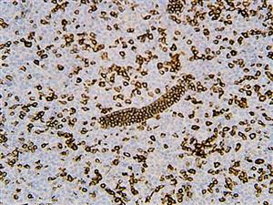 CD5, anti-cd5, anti cd5, CD5 antigen p56 62, CD5 molecule, LEU1, Lymphocyte antigen T1 Leu 1, T cell surface glycoprotei MAIN