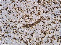 CD5, anti-cd5, anti cd5, CD5 antigen p56 62, CD5 molecule, LEU1, Lymphocyte antigen T1 Leu 1, T cell surface glycoprotei MAIN