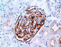 CD61 (EP65), RMab MAIN