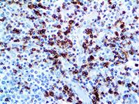 CD7 (LP15), MMab MAIN