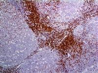 CD7 (EP132), RMab MAIN