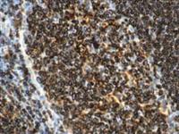 CD74 (LN2), MMab MAIN