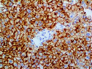 CD75 (LN-1), MMab MAIN