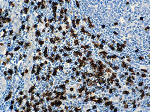 CD8 (C8/144B), MMab MAIN