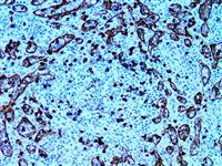 CD8 (EP334), RMab MAIN