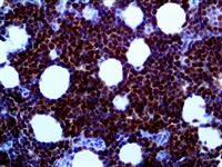 CDK2 (RBT-CDK2), RMab MAIN