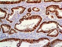 CDK4 (EP180), RMab MAIN