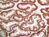 CDX2 (EP25), RMab MAIN