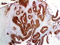 CEA (Polyclonal), RPab MAIN