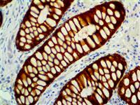Cytokeratin Cocktail AE1 & AE3 (AE1 & AE3), MMab MAIN