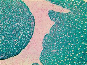 TintoFast CK AE1 & AE3 (AE1 & AE3), MMab MAIN