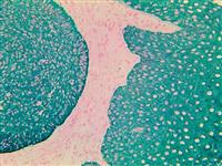 TintoFast CK AE1 & AE3 (AE1 & AE3), MMab MAIN