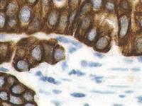 Cytokeratin HMW AE3 (AE3), MMab MAIN
