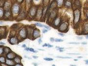 Cytokeratin HMW AE3 (AE3), MMab THUMBNAIL