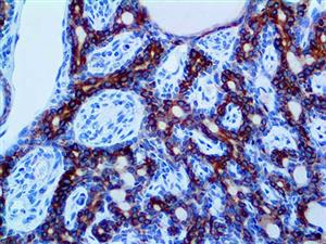 Cytokeratin LMW AE1 (AE1), MMab MAIN