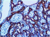 Cytokeratin LMW AE1 (AE1), MMab MAIN