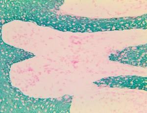 Cytokeratin, MNF116 (MNF116), MMab MAIN