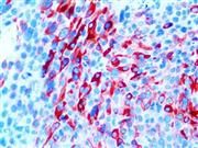 Cytokeratin 10 (EP97), RMab THUMBNAIL