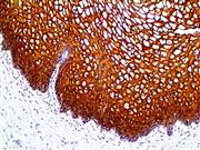 Cytokeratin 13 (EP69), RMab THUMBNAIL