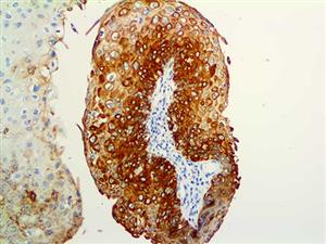Cytokeratin 17 (EP98), RMab MAIN