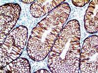Cytokeratin 18 (EP30), RMab MAIN