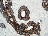 Cytokeratin 19 (RM364), RMab MAIN