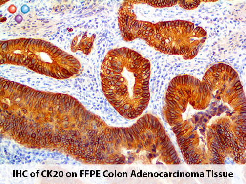 Cytokeratin 20 (Ks20.8), MMab MAIN