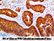 Cytokeratin 20 (Ks20.8), MMab SWATCH