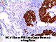 Cytokeratin 20 (Ks20.8), MMab SWATCH