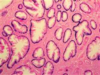 Cytokeratin HMW 34BE12 (34BetaE12), MMab MAIN