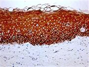 Cytokeratin 4 (EP4), RMab THUMBNAIL
