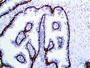 Cytokeratin 5 & 6 (D5 & 16B4), MMab THUMBNAIL