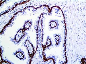 Cytokeratin 5 & 6 (EP24 & EP67), RMab MAIN