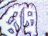 Cytokeratin 5 & 6 (EP24 & EP67), RMab MAIN