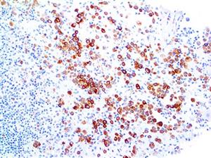 Cytokeratin 5 (EP24), RMab MAIN