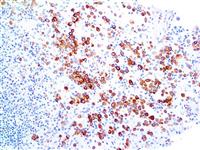 Cytokeratin 5 (EP24), RMab MAIN