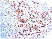 Cytokeratin 5 (EP24), RMab THUMBNAIL