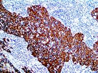 Cytokeratin 6 (EP67), RMab MAIN