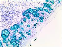 TintoFast CK7 (OV-TL 12/30), MMab MAIN