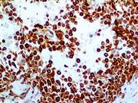 Cytokeratin 7 (OV-TL 12/30), MMab MAIN