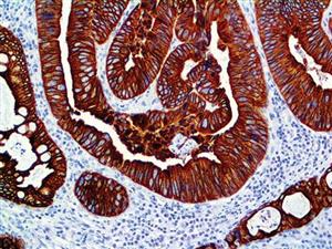 Cytokeratin 8 & 18 (B22.1 & B23.1), MMab MAIN