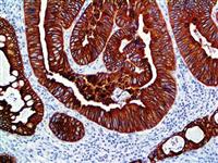 Cytokeratin 8 & 18 (B22.1 & B23.1), MMab MAIN